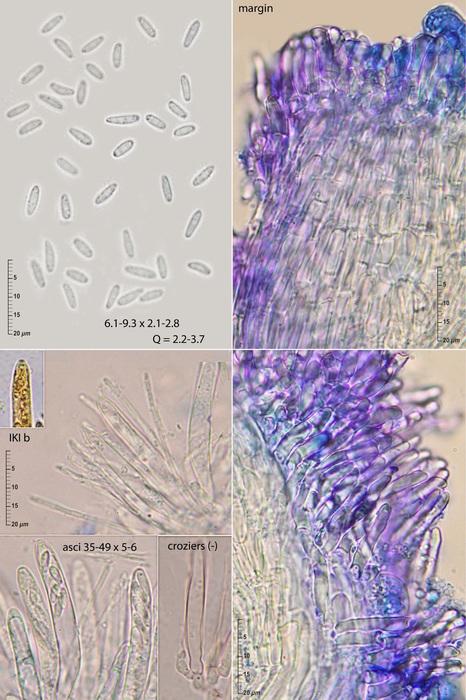 macrostoma
