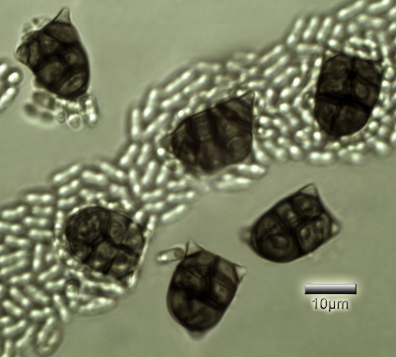 macrostoma