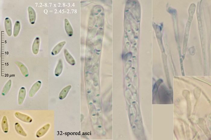 macrostoma
