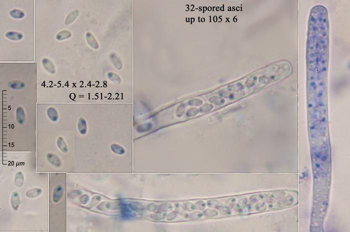 macrostoma