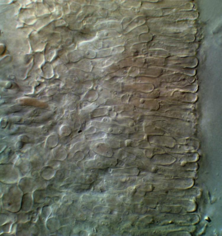 macrostoma