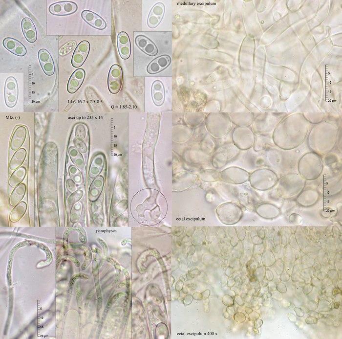 macrostoma