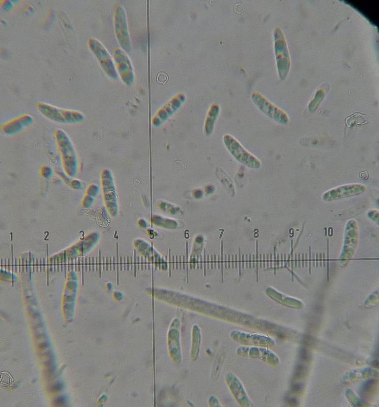 macrostoma
