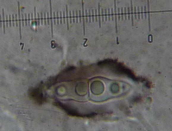 macrostoma