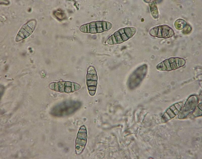 macrostoma