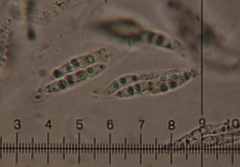 macrostoma