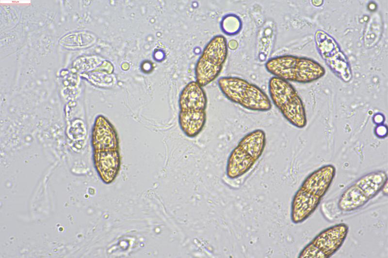 macrostoma