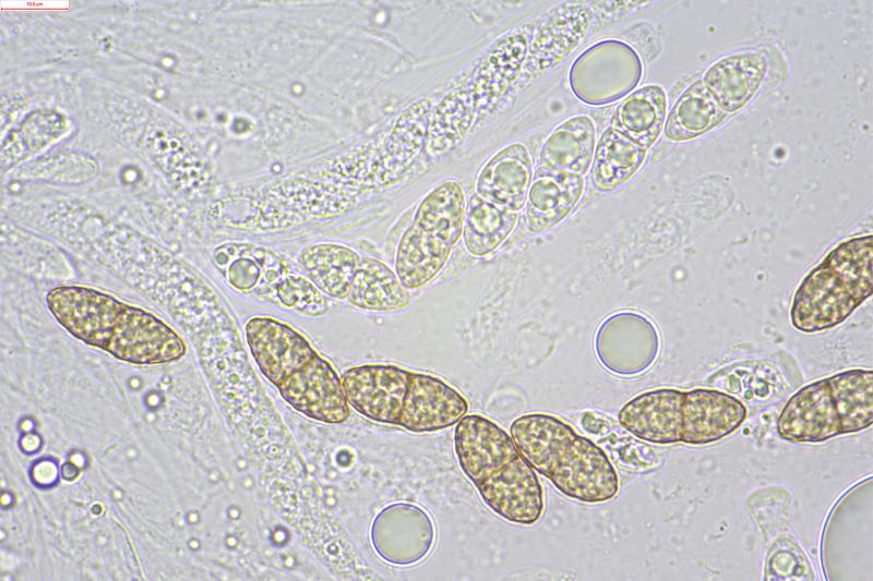 macrostoma