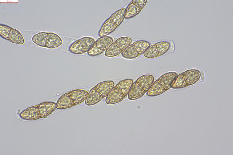 macrostoma