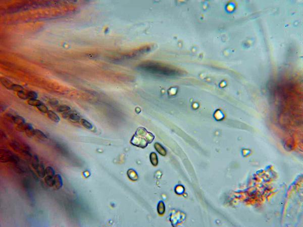 macrostoma
