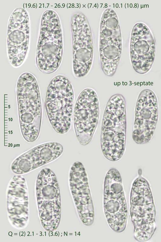 macrostoma
