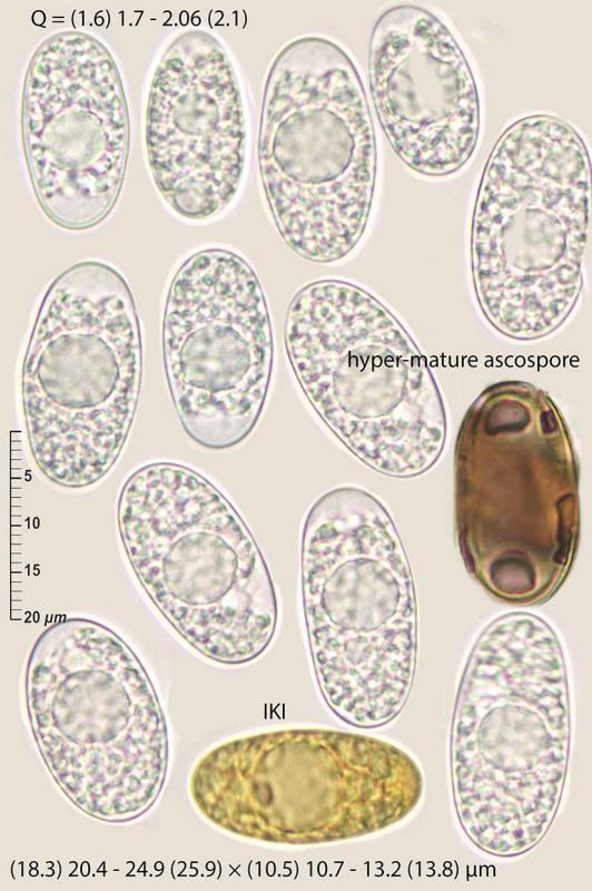 macrostoma
