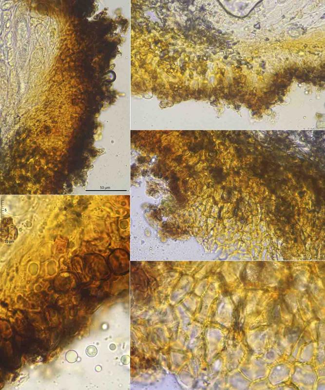 macrostoma