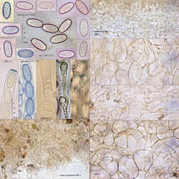 macrostoma