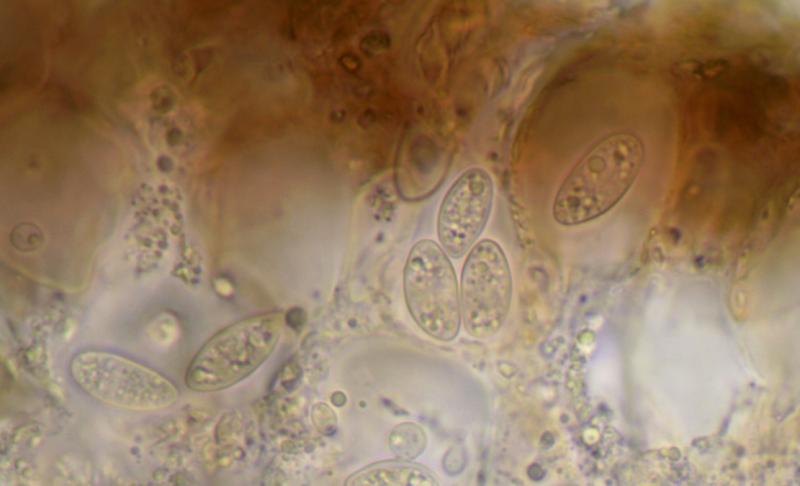 macrostoma