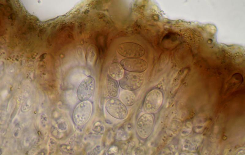 macrostoma