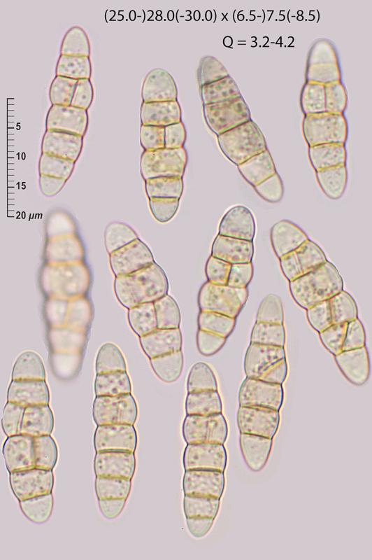 macrostoma