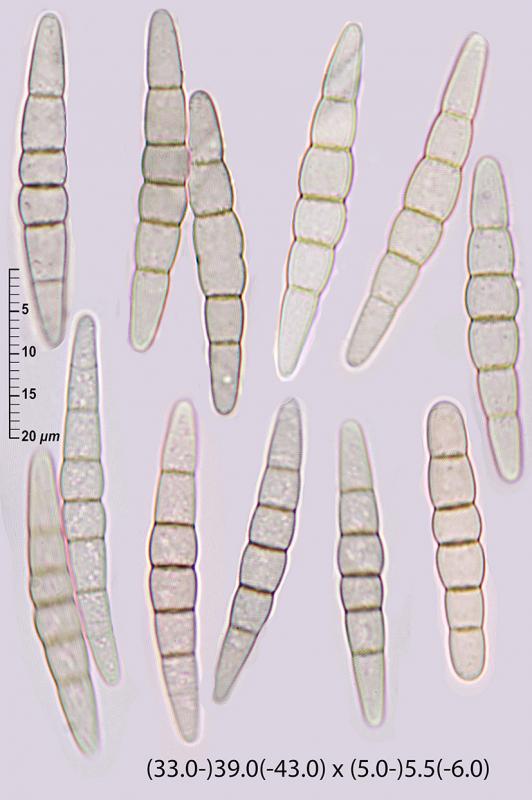 macrostoma