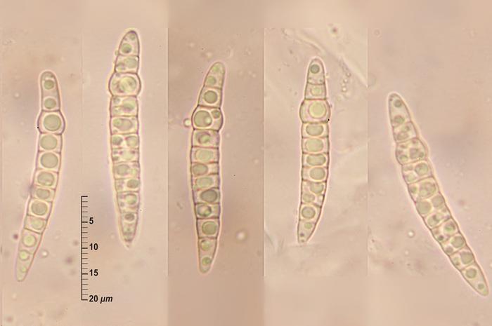 macrostoma