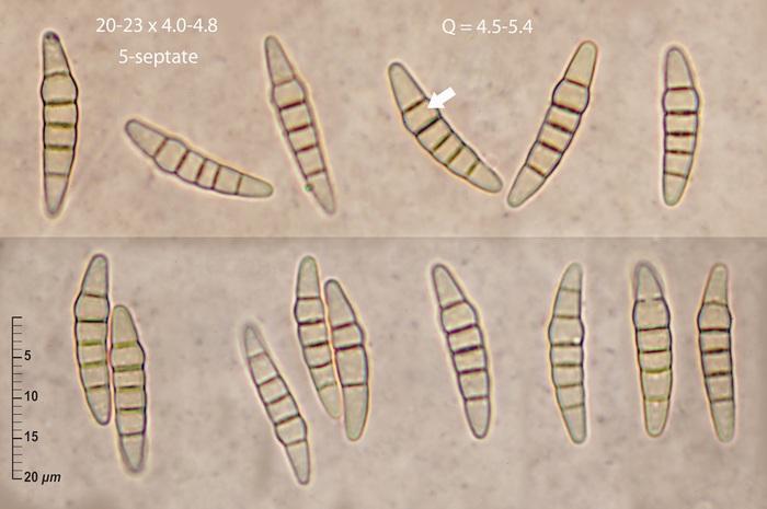 macrostoma
