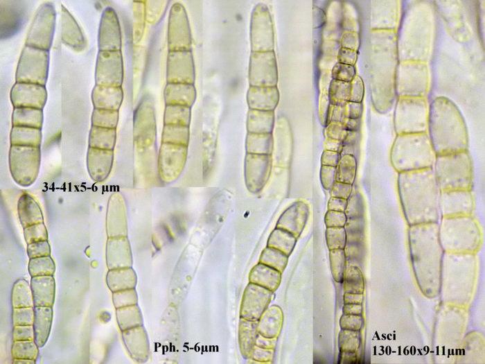 macrostoma
