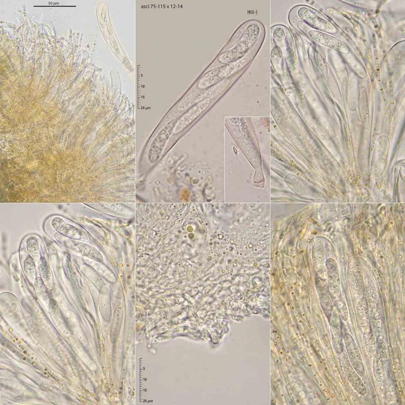 macrostoma