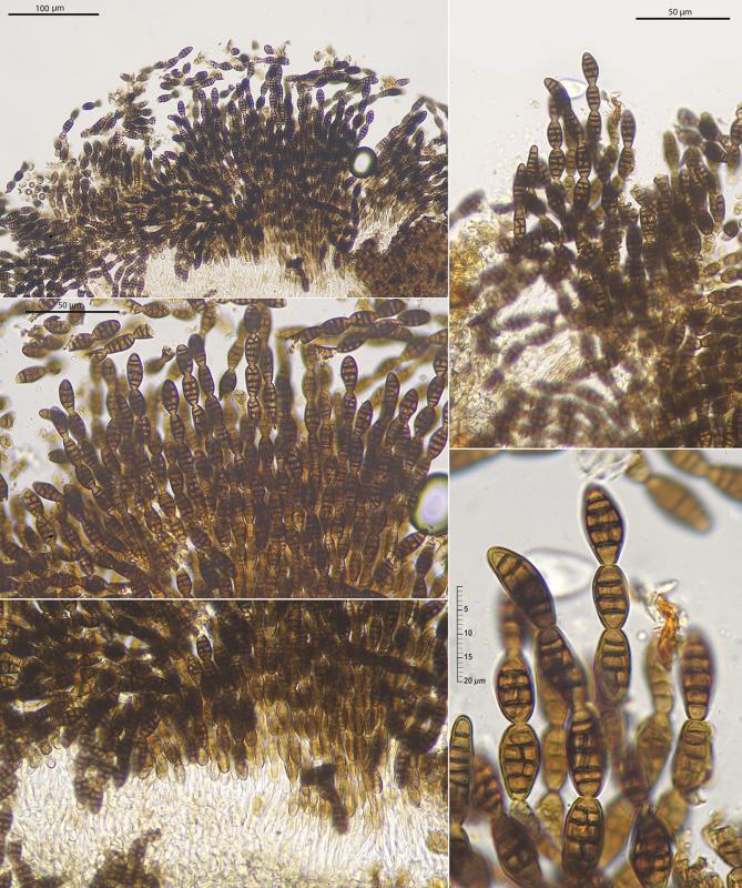 macrostoma