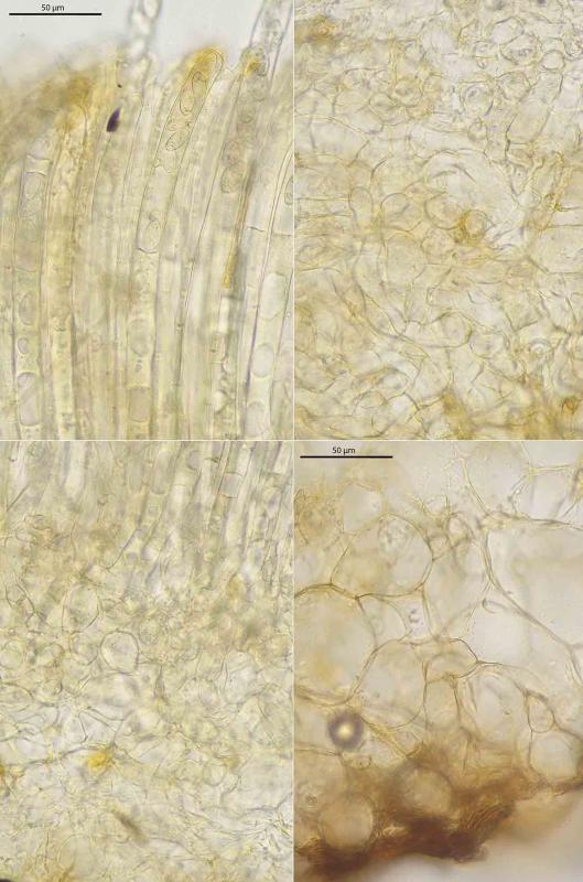 macrostoma