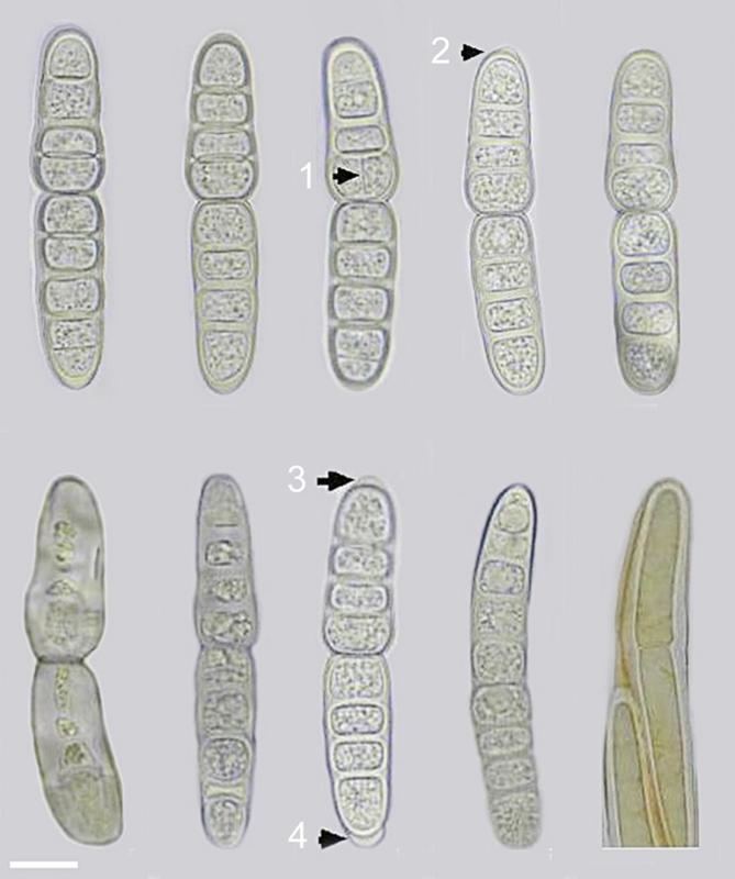 macrostoma