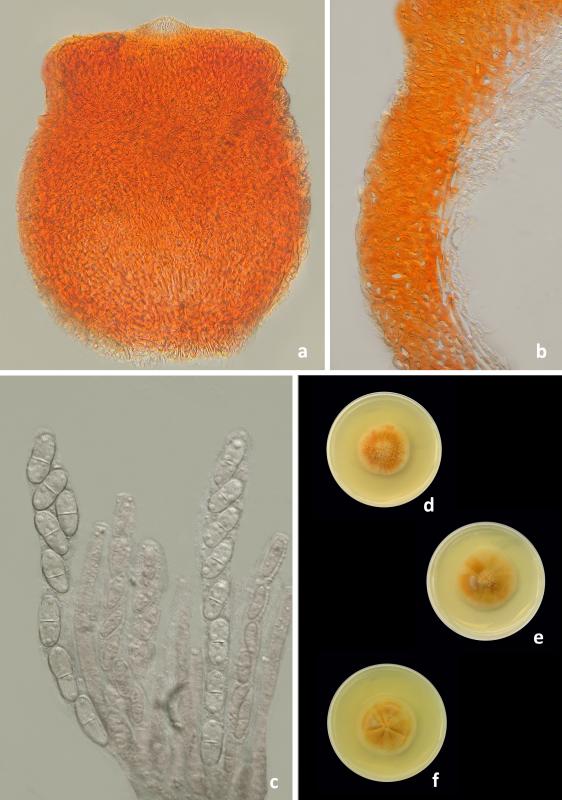 macrostoma