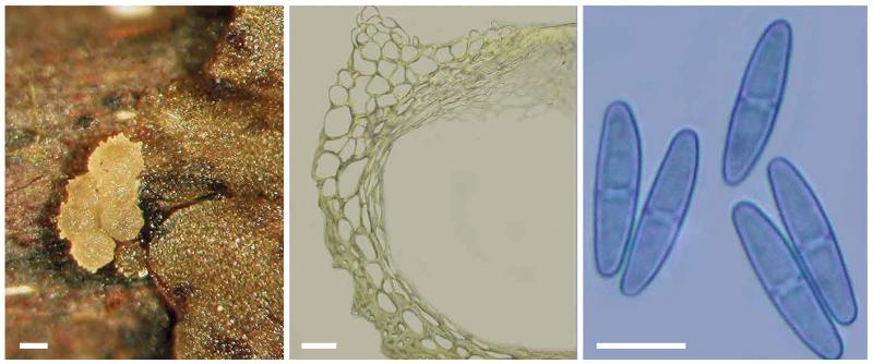 macrostoma