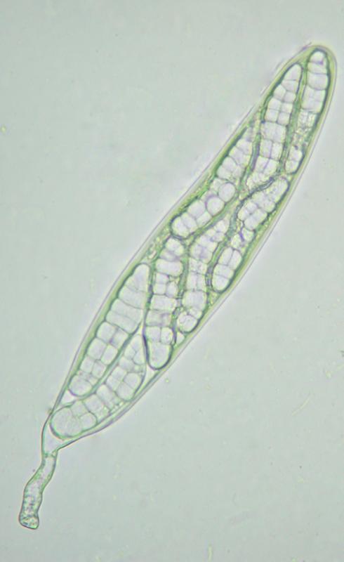macrostoma