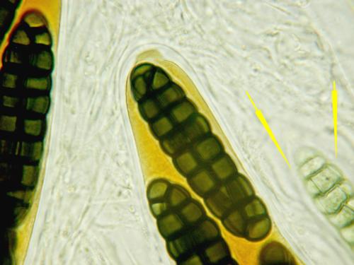 macrostoma