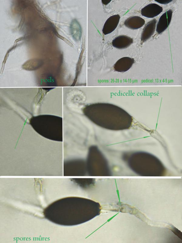 macrostoma