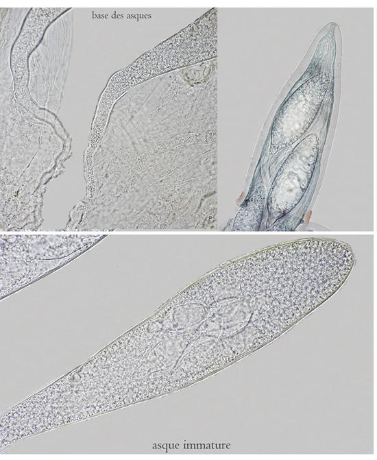 macrostoma