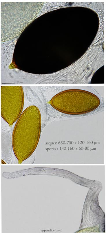 macrostoma