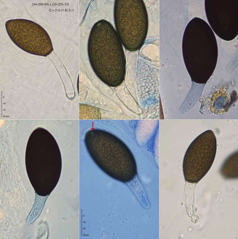 macrostoma