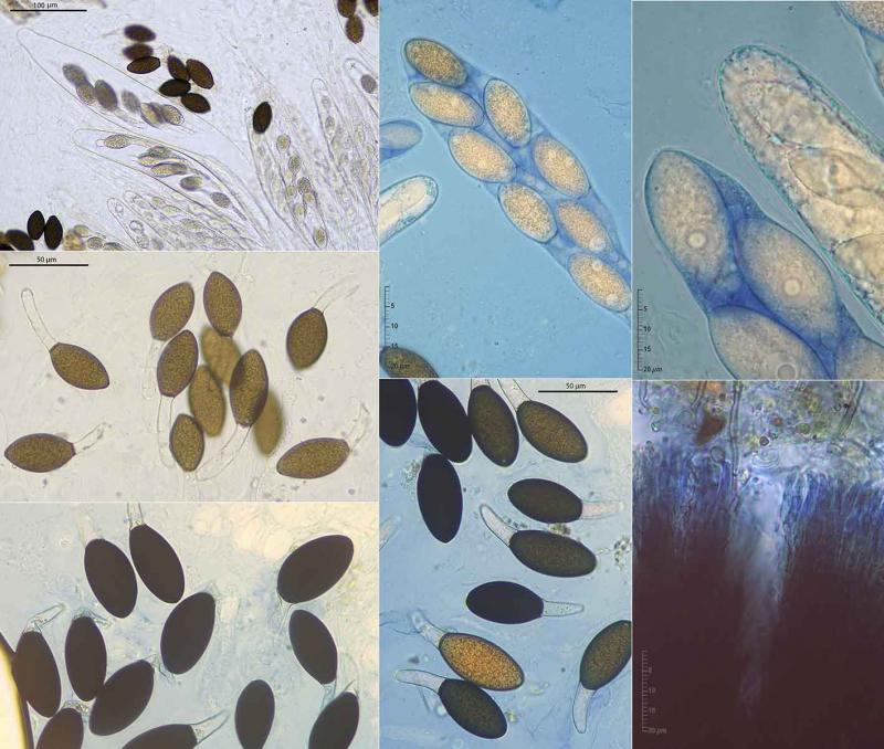 macrostoma