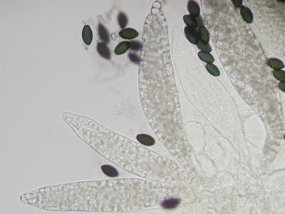 macrostoma