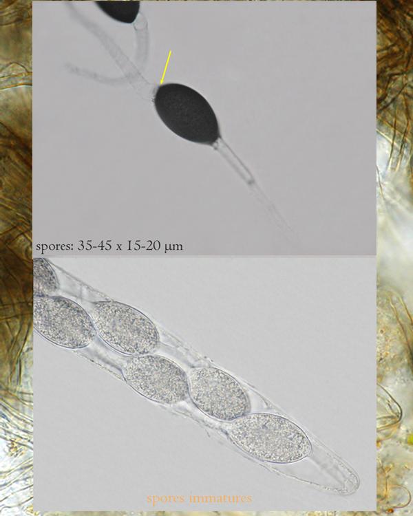 macrostoma
