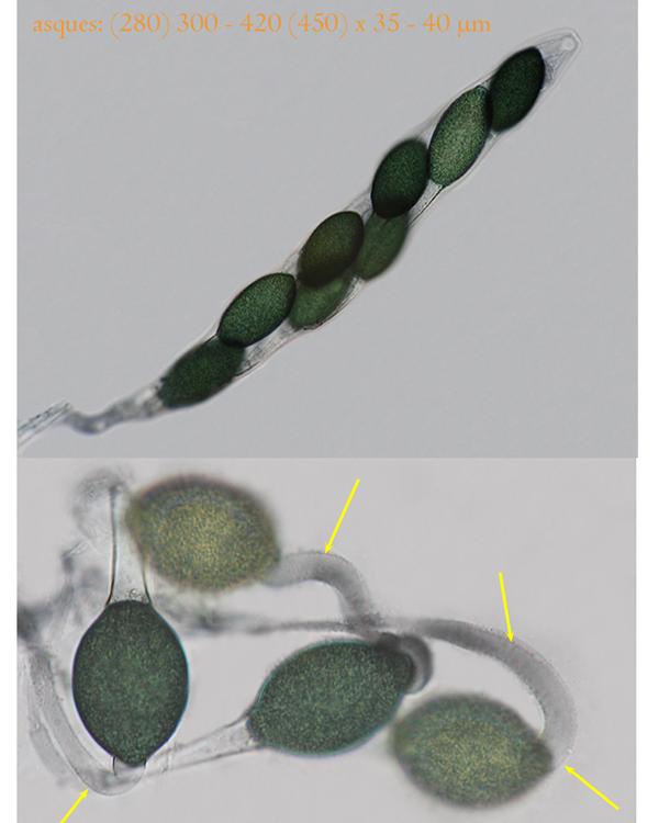 macrostoma