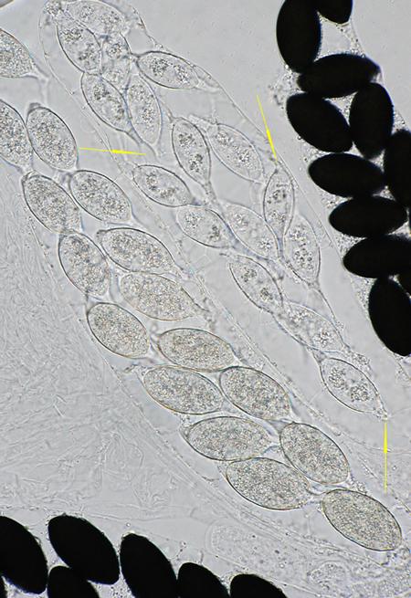 macrostoma