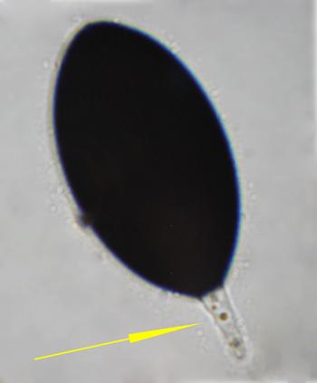macrostoma
