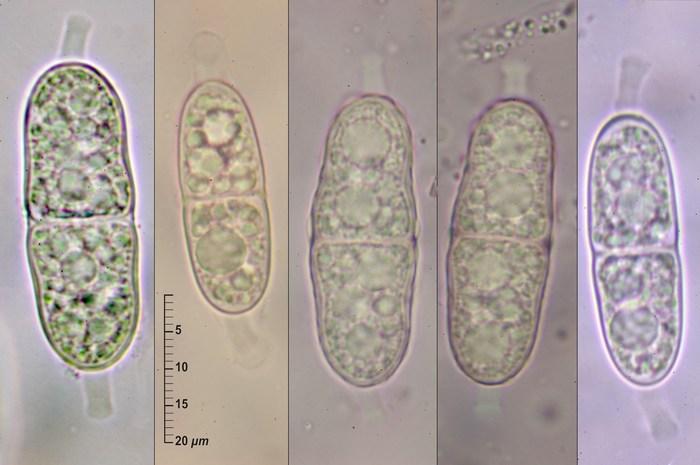 macrostoma