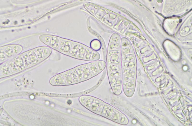 macrostoma