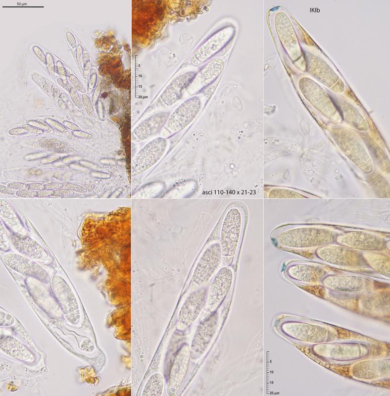 macrostoma