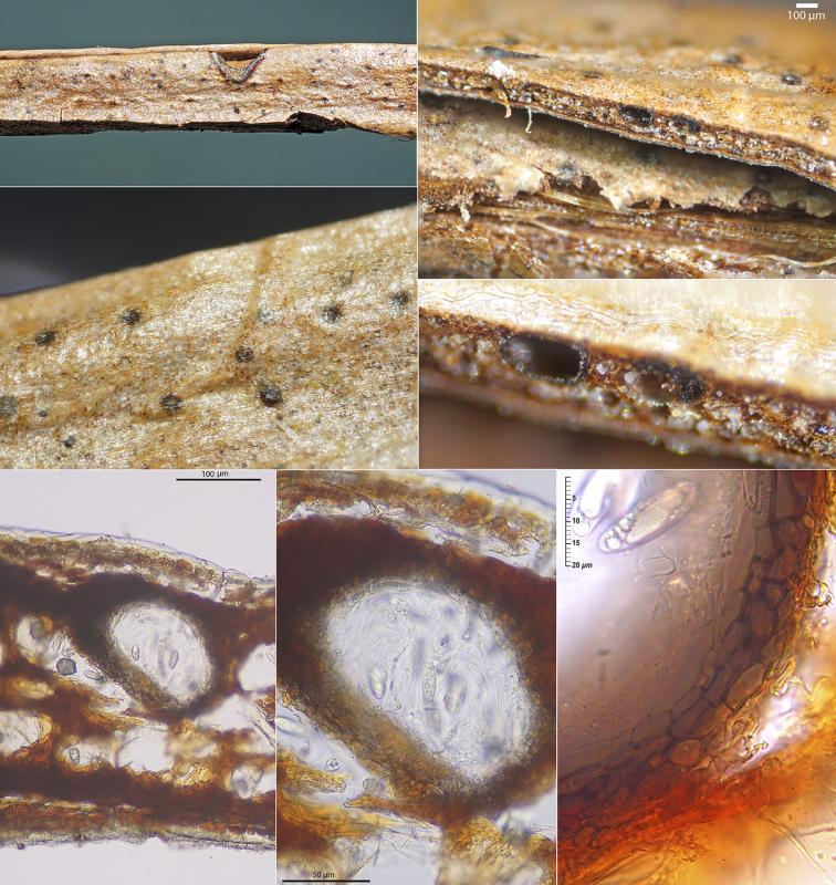 macrostoma