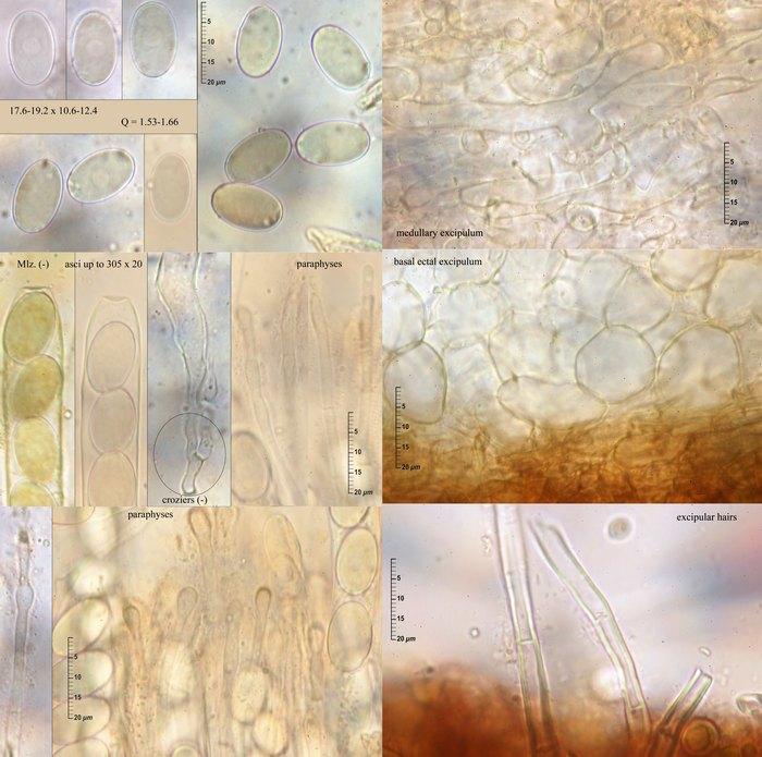 macrostoma
