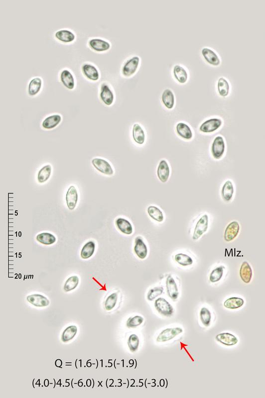 macrostoma