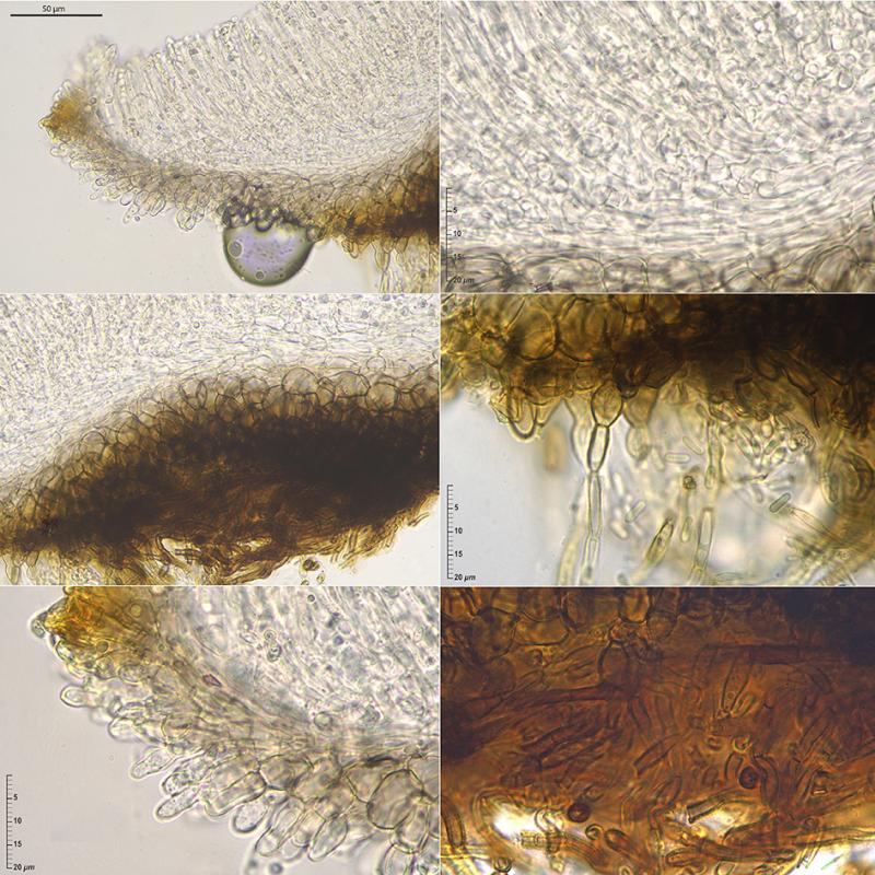 macrostoma